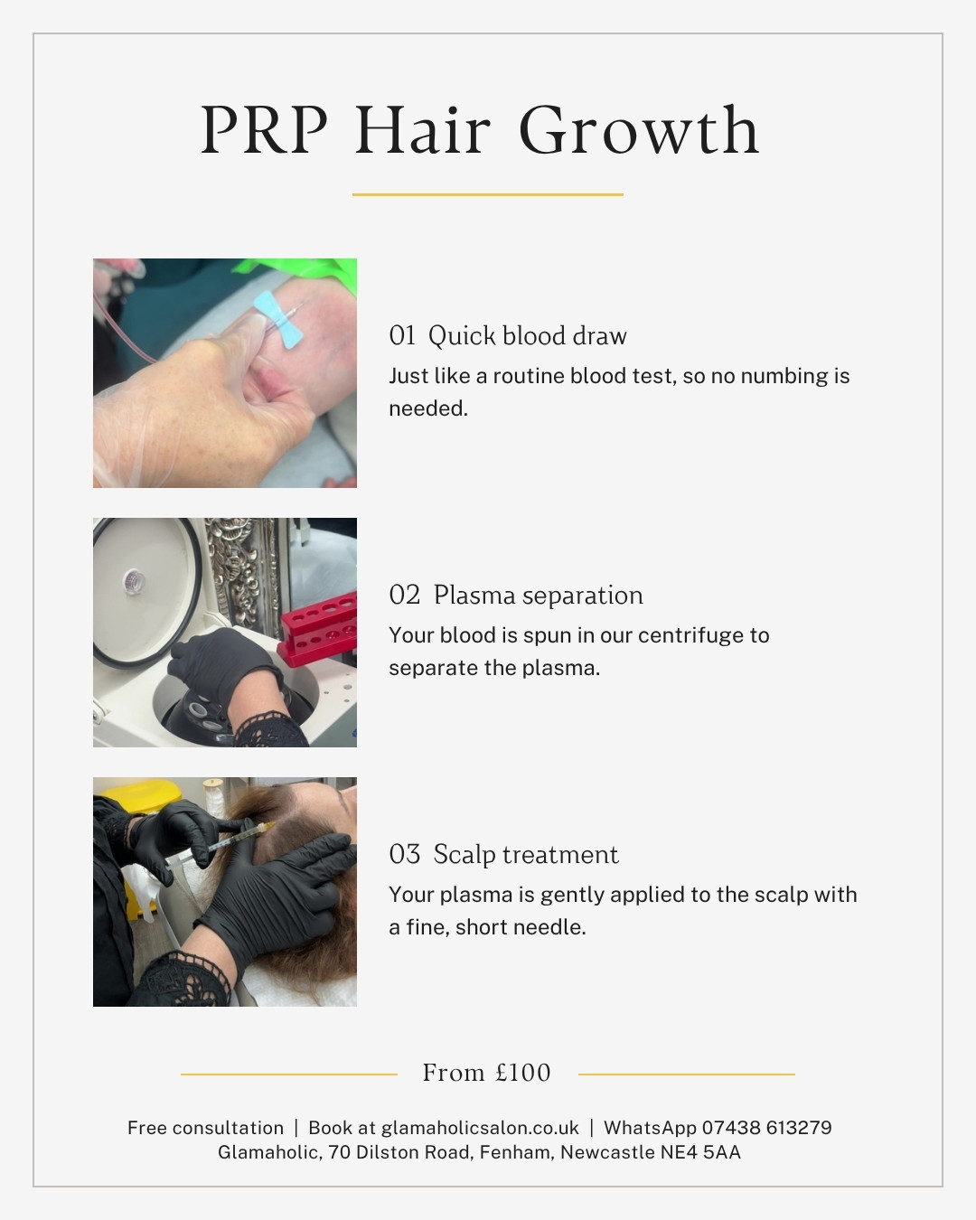 PRP Hair Growth in Newcastle