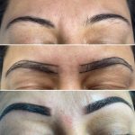 eyebrow treatment comparison photo