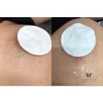 close up of treatment at Glamaholic Salon